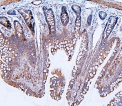 IHC staining of FFPE rat intestinal tissue with FLNB antibody. HIER: boil tissue sections in pH8 EDTA for 20 min and allow to cool before testing.