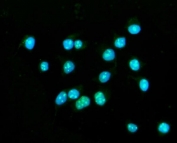 Immunofluorescent staining of FFPE human MCF7 cells with CENPB antibody (green) and DAPI nuclear stain (blue). HIER: steam section in pH6 citrate buffer for 20 min.