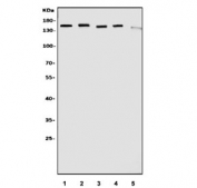 Western blot testing of 1) human K562, 2) human Raji, 3) human HeLa, 4) monkey COS-7 and 5) human Caco-2 cell lysate with Diaphanous Homolog 1 antibody. Predicted molecular weight ~140 kDa.