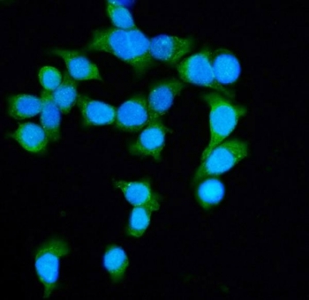Immunofluorescent staining of FFPE human Caco-2 cells with Diaphanous Homolog 1 antibody (green) and DAPI nuclear stain (blue). HIER: steam section in pH6 citrate buffer for 20 min.