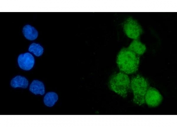 Immunofluorescent staining of FFPE human HepG2 cells with EEF2K antibody (green) and DAPI nuclear stain (blue). HIER: steam section in pH6 citrate buffer for 20 min.~