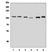 Western blot testing of 1) human HepG2, 2) human HEK293, 3) human PC-3, 4) human ThP-1, 5) rat PC-12 and 6) mouse RAW264.7 cell lysate with DNA Ligase 3 antibody. Predicted molecular weight ~113 kDa.