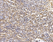 IHC staining of FFPE human ruptured spleen tissue with Epac1 antibody. HIER: boil tissue sections in pH8 EDTA for 20 min and allow to cool before testing.