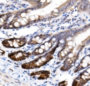 IHC staining of FFPE rat intestine tissue with SLC12A2 antibody. HIER: boil tissue sections in pH8 EDTA for 20 min and allow to cool before testing.