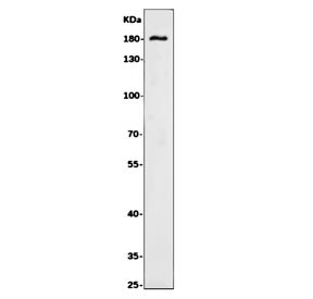 Western blot testing of human Caco-2 cell lysate with SLC12A2 antibody. Expected molecular weight: 130-180 kDa depending on glycosylation level.