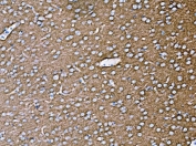 IHC staining of FFPE rat brain tissue with Synaptophysin antibody. HIER: boil tissue sections in pH8 EDTA for 20 min and allow to cool before testing.
