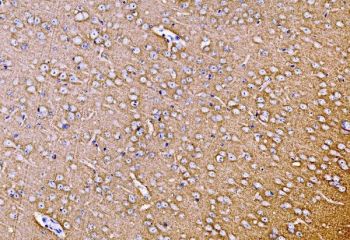IHC staining of FFPE mouse brain tissue with Synaptophysin antibody. HIER: boil tissue sections in pH8 EDTA for 20 min and allow to cool before testing.