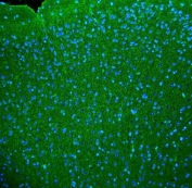 Immunofluorescent staining of FFPE mouse brain tissue with Synaptophysin antibody. HIER: boil tissue sections in pH8 EDTA for 20 min and allow to cool before testing.