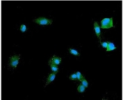 Immunofluorescent staining of FFPE human SH-SY5Y cells with Synaptophysin antibody (green) and DAPI nuclear stain (blue). HIER: steam section in pH6 citrate buffer for 20 min.
