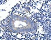 IHC staining of FFPE human appendicitis tissue with Synaptophysin antibody. HIER: boil tissue sections in pH8 EDTA for 20 min and allow to cool before testing.