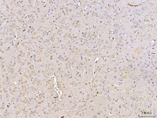 IHC staining of FFPE rat brain tissue with DUSP6 antibody. HIER: boil tissue sections in pH8 EDTA for 20 min and allow to cool before testing.