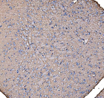 IHC staining of FFPE mouse brain tissue with IRBIT antibody. HIER: boil tissue sections in pH8 EDTA for 20 min and allow to cool before testing.