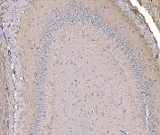 IHC staining of FFPE rat brain tissue with IRBIT antibody. HIER: boil tissue sections in pH8 EDTA for 20 min and allow to cool before testing.