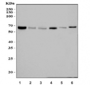 Western blot testing of 1) human HeLa, 2) human HEK293, 3) human HepG2, 4) human MCF7, 5) rat pancreas and 6) mouse pancreas tissue lysate with IRBIT antibody. Predicted molecular weight ~59 kDa.