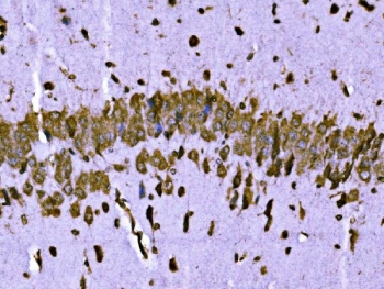 IHC staining of FFPE rat brain tissue with BRSK1 antibody. HIER: boil tissue sections in pH8 EDTA for 20 min and allow to cool before testing.