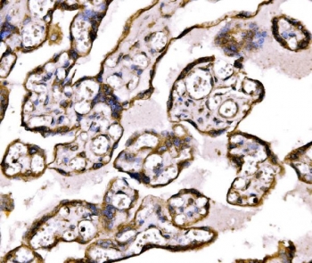 IHC staining of FFPE human placenta tissue with BRSK1 antibody. HIER: boil tissue sections in pH8 EDTA for 20 min and allow to cool before testing.