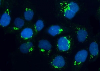 Immunofluorescent staining of FFPE human A431 cells with BRSK1 antibody (green) and DAPI nuclear stain (blue). HIER: steam section in pH6 citrate buffer for 20 min.