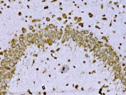 IHC staining of FFPE mouse brain tissue with BRSK1 antibody. HIER: boil tissue sections in pH8 EDTA for 20 min and allow to cool before testing.