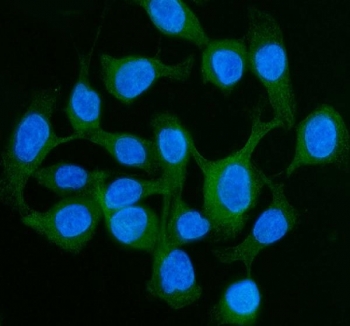 Immunofluorescent staining of FFPE human rectal cancer tissue with CDH17 antibody (red) and DAPI nuclear stain (blue). HIER: boil tissue sections in pH8 EDTA for 20 min and allow to cool before testing.
