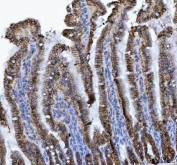 IHC staining of FFPE mouse colon tissue with CDH17 antibody. HIER: boil tissue sections in pH8 EDTA for 20 min and allow to cool before testing.