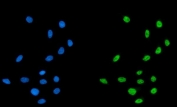 Immunofluorescent staining of FFPE human MCF7 cells with CPSF6 antibody (green) and DAPI nuclear stain (blue). HIER: steam section in pH6 citrate buffer for 20 min.