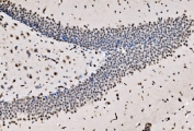 IHC staining of FFPE mouse brain tissue with CPSF6 antibody. HIER: boil tissue sections in pH8 EDTA for 20 min and allow to cool before testing.