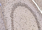 IHC staining of FFPE rat brain tissue with CPSF6 antibody. HIER: boil tissue sections in pH8 EDTA for 20 min and allow to cool before testing.