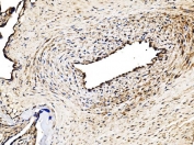 IHC staining of FFPE human placental tissue with Glycogen synthase 1 antibody. HIER: boil tissue sections in pH8 EDTA for 20 min and allow to cool before testing.