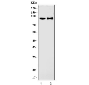 Western blot testing of 1) rat skeletal muscle and 2) mouse skeletal muscle tissue lysate with Glycogen synthase 1 antibody. Predicted molecular weight ~84 kDa.