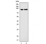 Western blot testing of 1) rat skeletal muscle and 2) mouse skeletal muscle tissue lysate with Glycogen synthase 1 antibody. Predicted molecular weight ~84 kDa.