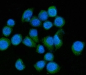 Immunofluorescent staining of FFPE human SiHa cells with MLXIP antibody (green) and DAPI nuclear stain (blue). HIER: steam section in pH6 citrate buffer for 20 min.