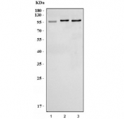 Western blot testing of human 1) HepG2, 2) K562 and 3) HEK293 cell lysate with MLXIP antibody. Predicted molecular weight ~101 kDa.