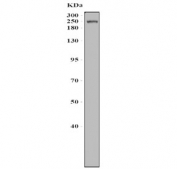 Western blot testing of rat heart tissue with Myosin Heavy Chain 3 antibody. Predicted molecular weight ~224 kDa.