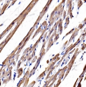 IHC staining of FFPE rat heart tissue with Myosin Heavy Chain 3 antibody. HIER: boil tissue sections in pH8 EDTA for 20 min and allow to cool before testing.