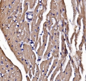 IHC staining of FFPE mouse heart tissue with Myosin Heavy Chain 3 antibody. HIER: boil tissue sections in pH8 EDTA for 20 min and allow to cool before testing.
