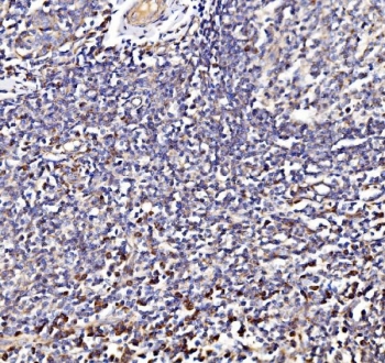 IHC staining of FFPE human tonsil tissue with NDUFAF1 antibody. HIER: boil tissue sections in pH8 EDTA for 20 min and allow to cool before testing.