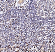 IHC staining of FFPE human tonsil tissue with NDUFAF1 antibody. HIER: boil tissue sections in pH8 EDTA for 20 min and allow to cool before testing.