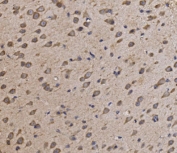 IHC staining of FFPE mouse brain tissue with NDUFAF1 antibody. HIER: boil tissue sections in pH8 EDTA for 20 min and allow to cool before testing.