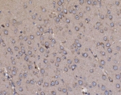 IHC staining of FFPE rat brain tissue with NDUFAF1 antibody. HIER: boil tissue sections in pH8 EDTA for 20 min and allow to cool before testing.