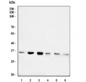 Western blot testing of 1) human HeLa, 2) human Jurkat, 3) human HEK293, 4) rat liver, 5) rat heart and 6) mouse liver tissue lysate with NDUFAF1 antibody. Predicted molecular weight ~38 kDa.