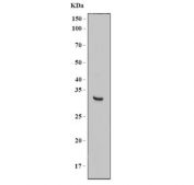 Western blot testing of human HeLa cell lysate with RPL5 antibody. Predicted molecular weight ~34 kDa.