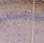 IHC staining of FFPE rat brain tissue with Endophilin A1 antibody. HIER: boil tissue sections in pH8 EDTA for 20 min and allow to cool before testing.