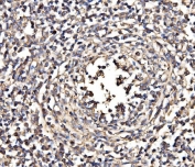 IHC staining of FFPE human testis large B cell tumor tissue with NEAS antibody. HIER: boil tissue sections in pH8 EDTA for 20 min and allow to cool before testing.