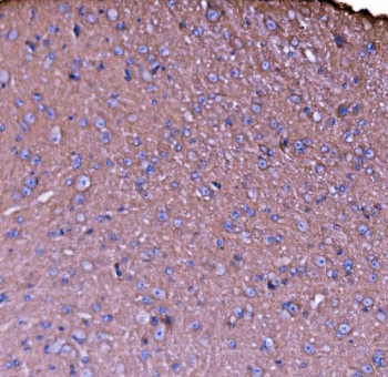 IHC staining of FFPE mouse brain tissue with NEAS antibody. HIER: boil tissue sections in pH8 EDTA for 20 min and allow to cool before testing.