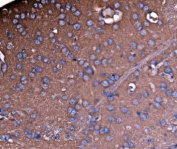 IHC staining of FFPE rat brain tissue with NEAS antibody. HIER: boil tissue sections in pH8 EDTA for 20 min and allow to cool before testing.