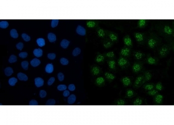 Immunofluorescent staining of FFPE human A431 cells with TMED5 antibody (green) and DAPI nuclear stain (blue). HIER: steam section in pH6 citrate buffer for 20 min.~