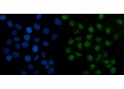Immunofluorescent staining of FFPE human A431 cells with TMED5 antibody (green) and DAPI nuclear stain (blue). HIER: steam section in pH6 citrate buffer for 20 min.