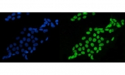Immunofluorescent staining of FFPE human A431 cells with Splicing factor 1 antibody (green) and DAPI nuclear stain (blue). HIER: steam section in pH6 citrate buffer for 20 min.