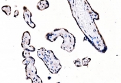 IHC staining of FFPE human placental tissue with Splicing factor 1 antibody. HIER: boil tissue sections in pH8 EDTA for 20 min and allow to cool before testing.