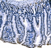 IHC staining of FFPE mouse colon tissue with Splicing factor 1 antibody. HIER: boil tissue sections in pH8 EDTA for 20 min and allow to cool before testing.